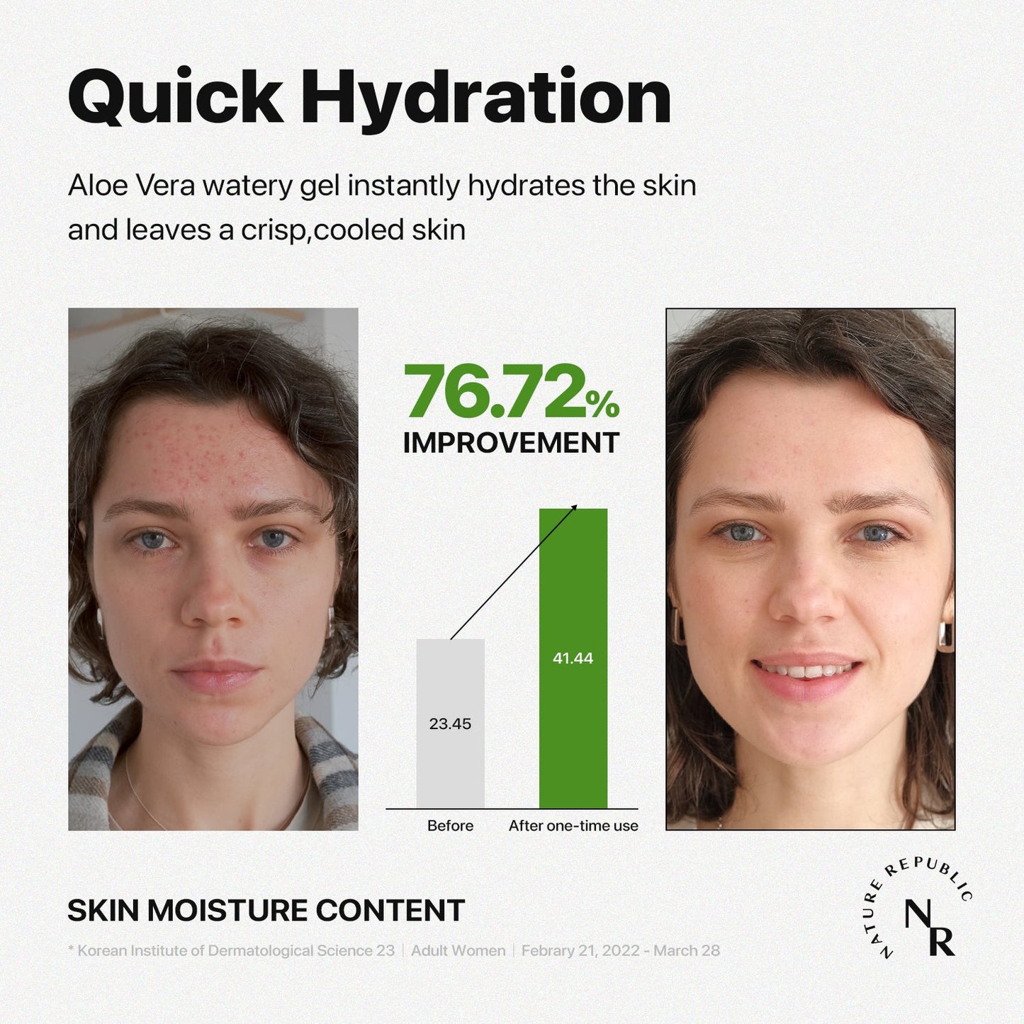 NATURE REPUBLIC Gel acuoso de aloe vera suave y humectante 300 ml / 10,56 fl. onz.